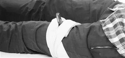 沈阳一男子骑行遭遇车祸，自行车踏板轴刺入足底