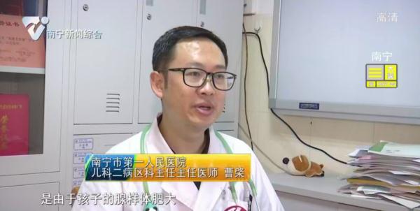 “腺样体面容”登热搜!孩子打鼾家长应注意 “腺样体面容”登热搜!孩子打鼾家长应注意