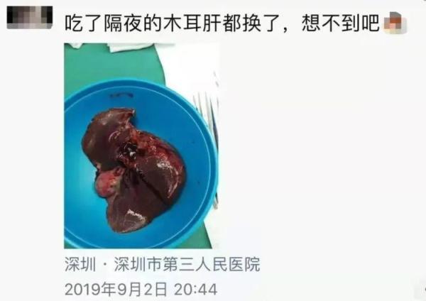 警惕！病死率超过50%！很多人好这一口……
