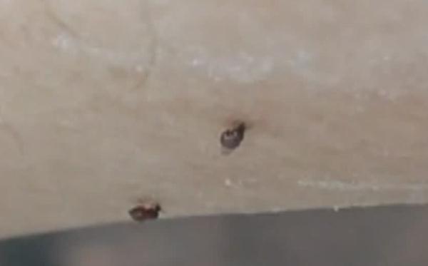 警惕！被这种小虫咬后奇痒无比，广东户外很常见