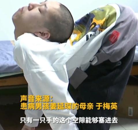 山东“折叠男孩”跪着上课考上大学,祝他手术顺利! 山东“折叠男孩”跪着上课考上大学,祝他手术顺利!
