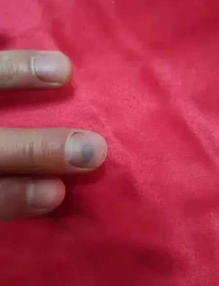 跪地救人的新郎胡鹏刚，你真帅！