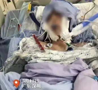 警惕!一女生洗澡触电被送进ICU 警惕!一女生洗澡触电被送进ICU