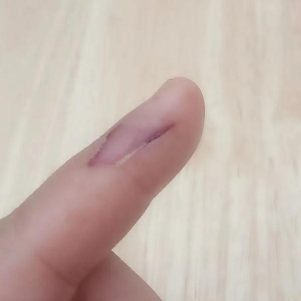 破防了!看到这些年轻人的手,网友纷纷竖起大拇指! 破防了!看到这些年轻人的手,网友纷纷竖起大拇指!