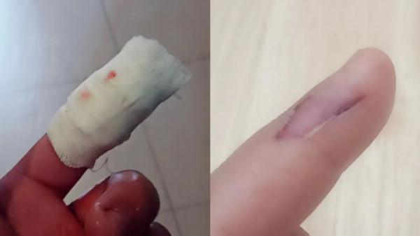 破防了!看到这些年轻人的手,网友纷纷竖起大拇指! 破防了!看到这些年轻人的手,网友纷纷竖起大拇指!