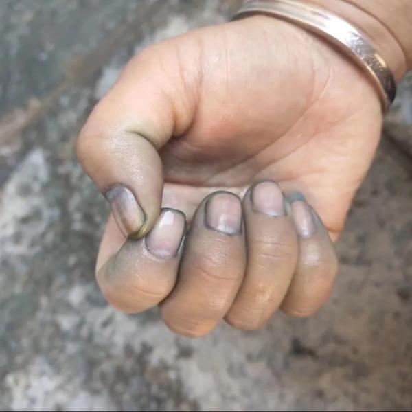 破防了!看到这些年轻人的手,网友纷纷竖起大拇指! 破防了!看到这些年轻人的手,网友纷纷竖起大拇指!