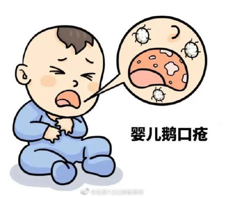 新生儿为什么会感染鹅口疮? 新生儿为什么会感染鹅口疮?