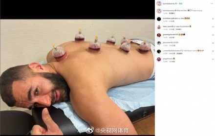 本泽马体验中医拔罐 本泽马体验中医拔罐