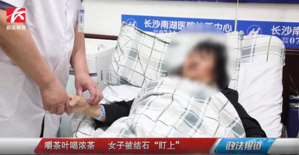 干嚼茶叶当饭吃，女子结石频发