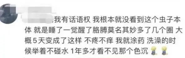 毒液堪比硫酸，有人被毁容！这种虫千万别拍！