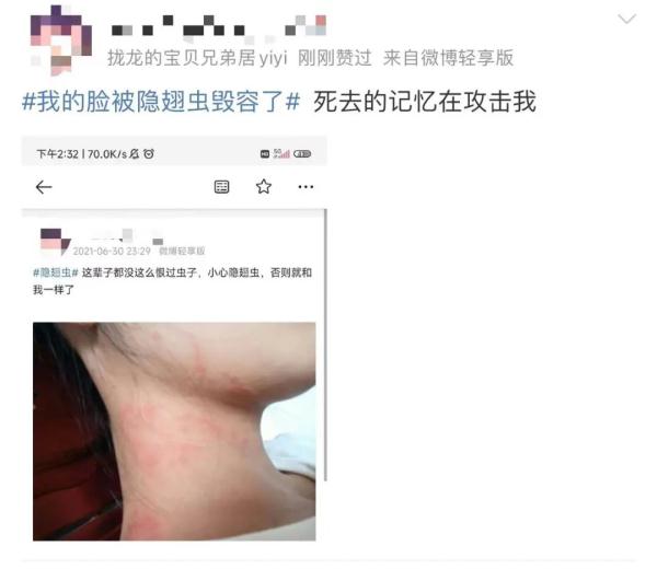 “我的脸被它毁容了”！重要提醒：这种虫千万别拍，毒液堪比硫酸