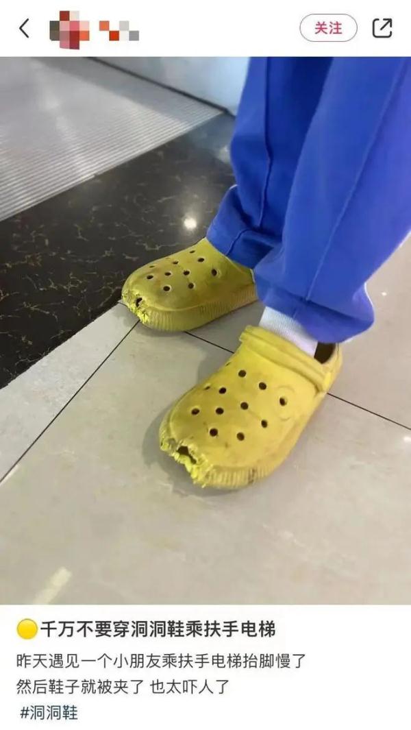 危险！因为穿了这个鞋，有人半个脚趾没了……