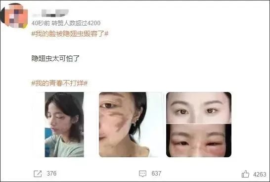 “我的脸被它毁容了！”遇到这种虫子，千万别用手拍