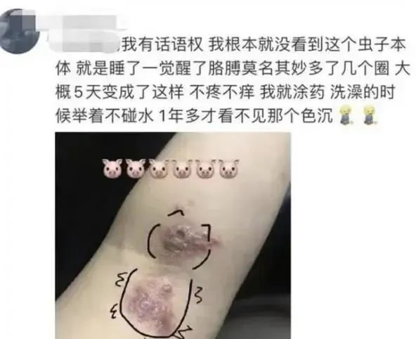 “我的脸被它毁容了！”遇到这种虫子，千万别用手拍