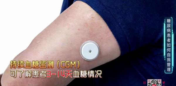 致盲原因排第一！这些人最危险！如何筛查和自我管理？专家支招！