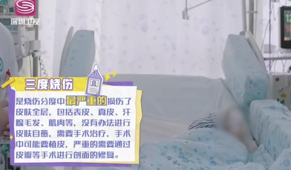 孩子重度烫伤9天才送医，爸爸的话令人震惊...
