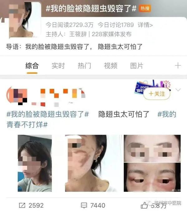 一觉醒来,杭州大伯胸口着火般的辣!医生提醒… 一觉醒来,杭州大伯胸口着火般的辣!医生提醒…