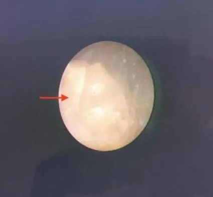 扩散丨宁夏3岁幼童突发腹痛、血尿，医生紧急提醒！