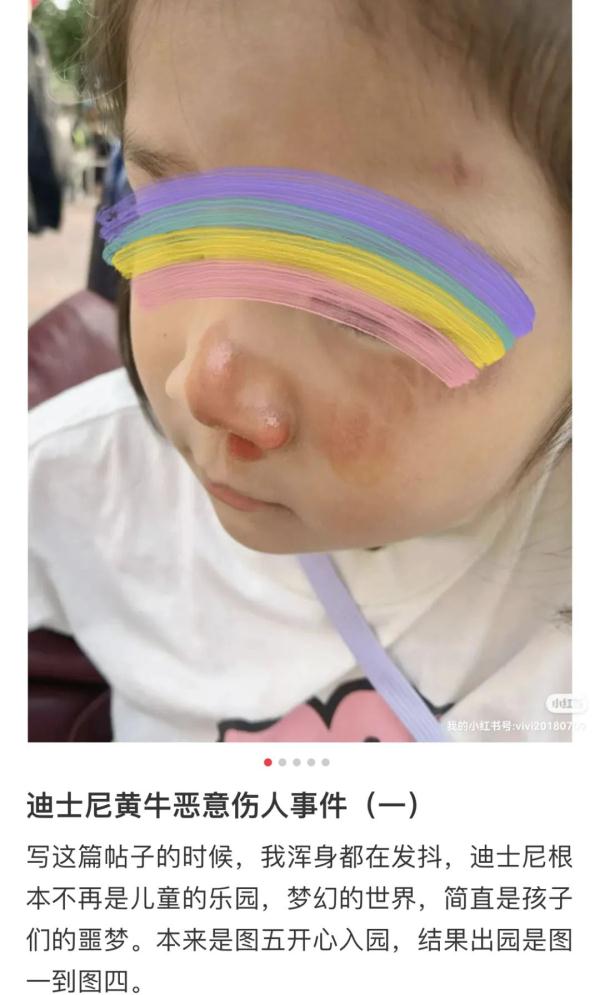 5岁女童在上海迪士尼被“排队黄牛”恶意推倒受伤？回应来了