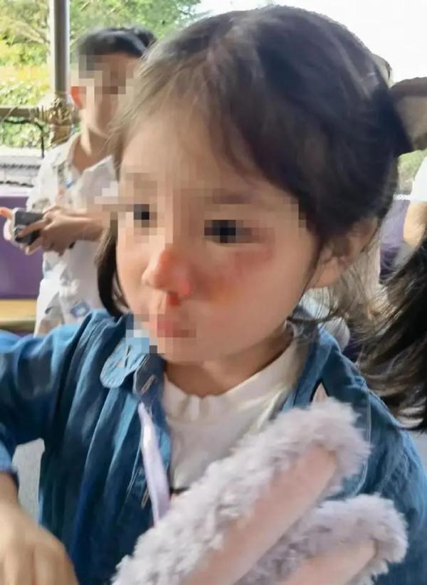 女童在上海迪士尼被黄牛恶意推倒受伤？家长：孩子脸贴地飞出三四米……