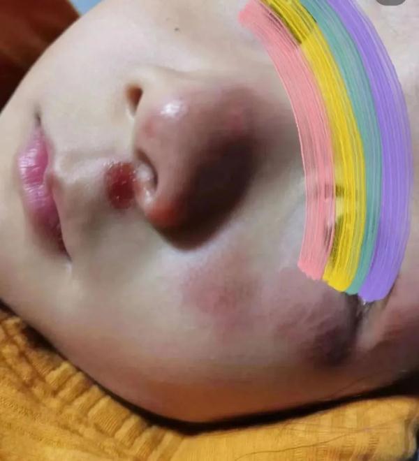 女童在上海迪士尼被黄牛恶意推倒受伤？家长：孩子脸贴地飞出三四米……