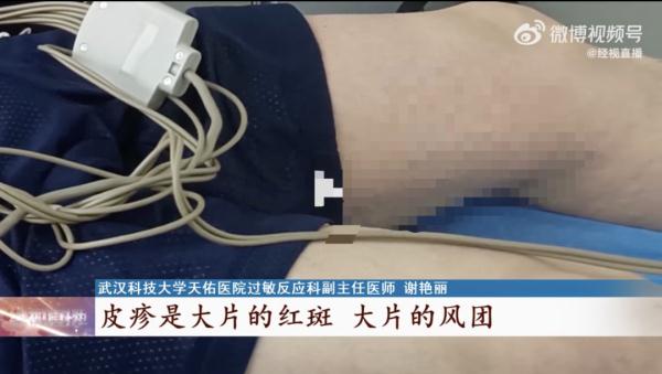 男子因一碗面被送去抢救！已经第3次了…网友：到底有多好吃？