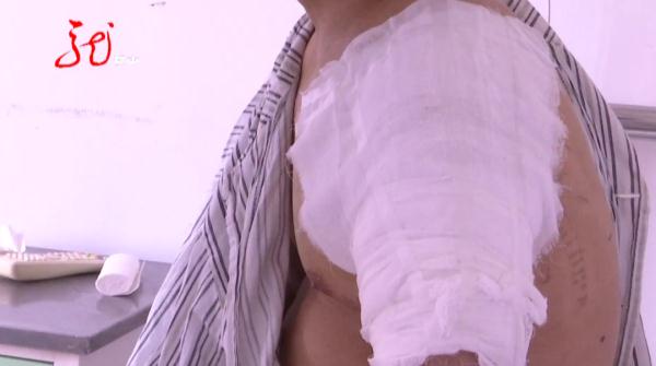 胆小勿点！一男子高空坠落，钢筋贯穿身体！