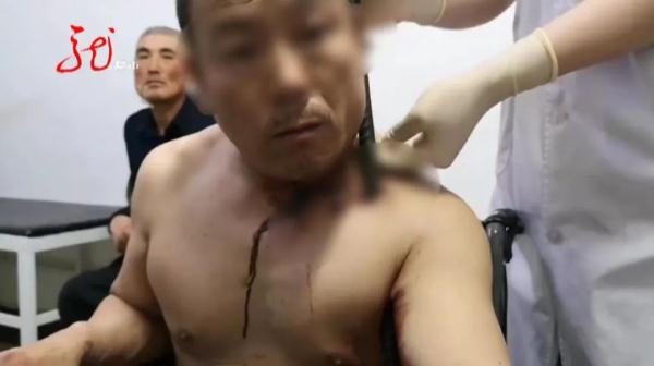 胆小勿点！一男子高空坠落，钢筋贯穿身体！