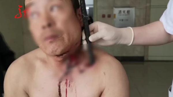 胆小勿点！一男子高空坠落，钢筋贯穿身体！