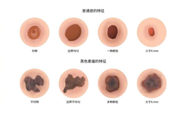 惋惜！37岁男歌手去世，儿子不满1岁，这种病极度凶险