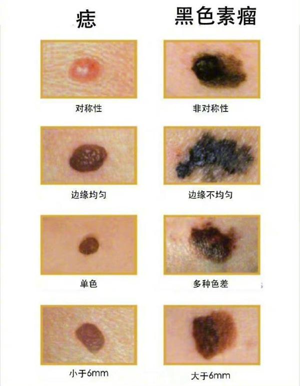 惋惜！37岁男歌手去世，儿子不满1岁，这种病极度凶险