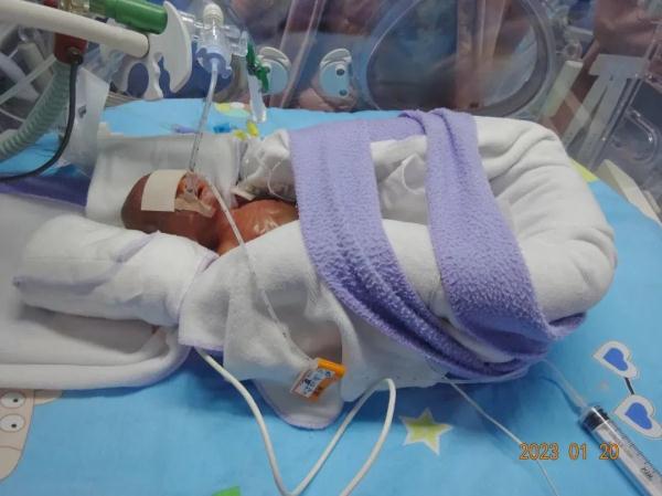 奇迹宝宝!“全国最轻”早产儿145天闯过重重生死关! 奇迹宝宝!“全国最轻”早产儿145天闯过重重生死关!