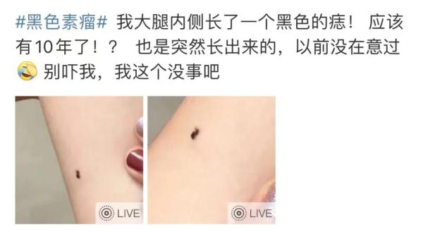 知名男歌手去世,年仅37岁…身上有它要警惕! 知名男歌手去世,年仅37岁…身上有它要警惕!