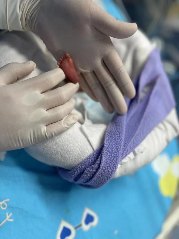 奇迹!“全国最轻”早产儿在厦门出院! 奇迹!“全国最轻”早产儿在厦门出院!