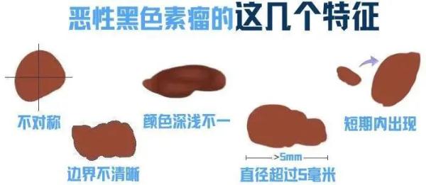 这病又上热搜！37岁男明星因此去世 自查重点来了