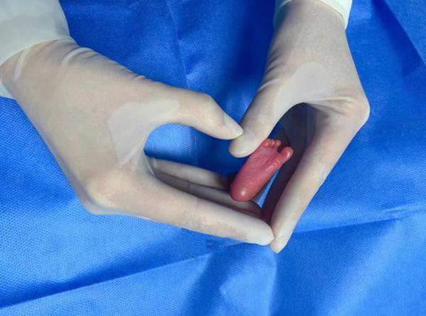 湖南胎龄最小的“巴掌宝宝”闯关132天后……