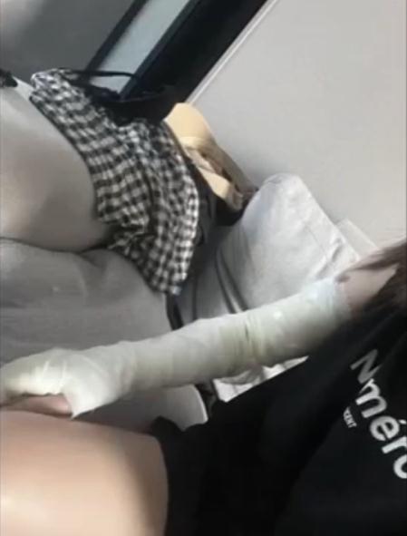 氢气球遇上吹风机爆炸，女子被大面积烧伤
