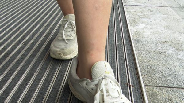 多处受伤！共享电动车刹车失灵，女子撞上路边围栏才停下