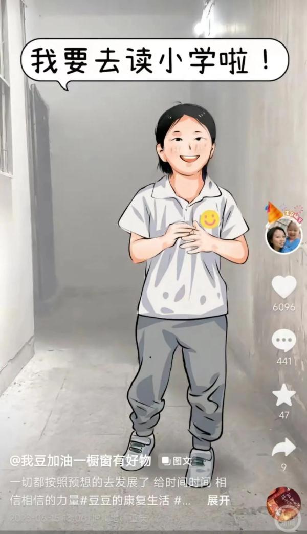 脑瘫女孩豆豆9月即将上小学，妈妈：边上学边康复训练