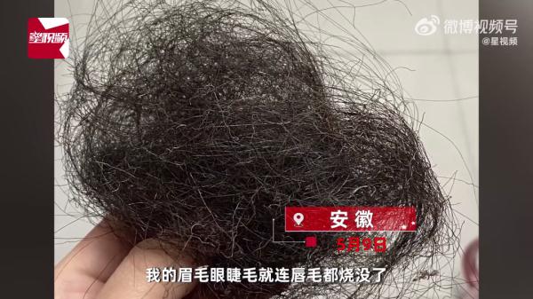 瞬间爆燃！孩子玩氢气球砸向吹风机引起爆燃，妈妈被大面积烧伤……