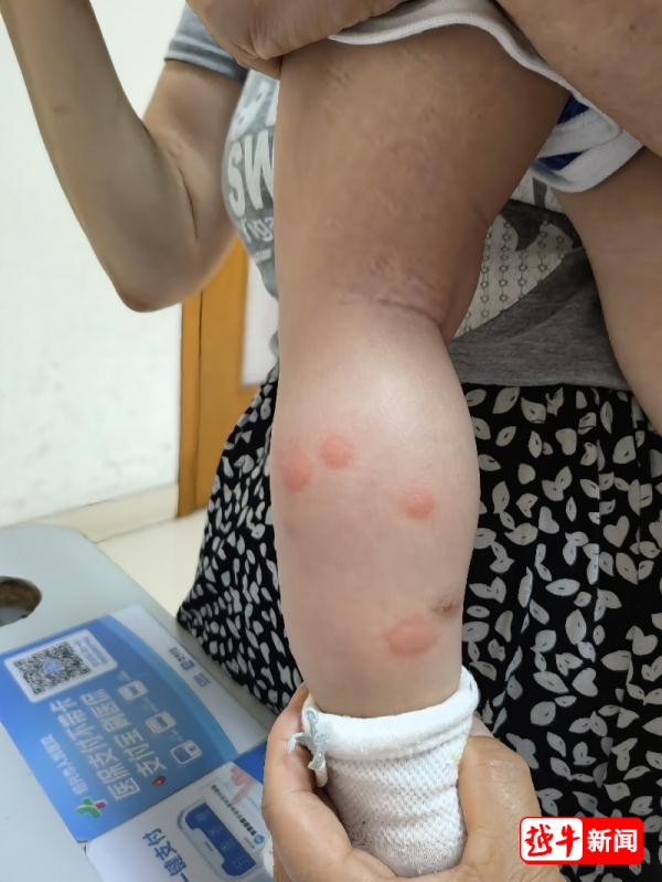 紧急提醒！一天发现20例！