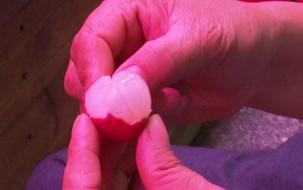 紧急提醒:又一例因它中毒!千万别空腹吃 紧急提醒:又一例因它中毒!千万别空腹吃