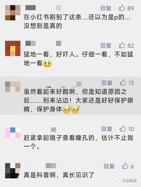 瞳孔突然变成三角形!医生紧急提醒→ 瞳孔突然变成三角形!医生紧急提醒→