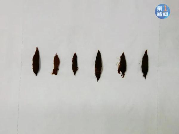 警惕！西安已有多人中招！遇到这种情况速去医院