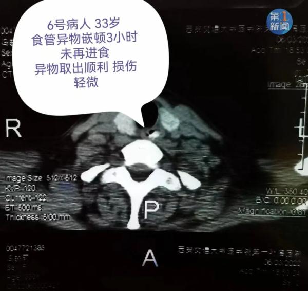 警惕！西安已有多人中招！遇到这种情况速去医院
