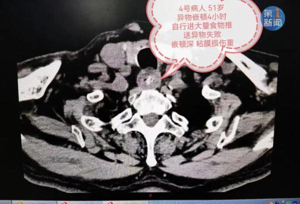 警惕！西安已有多人中招！遇到这种情况速去医院