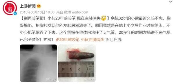 惊险！青岛一小学生咳嗽、发热8天，CT检查竟发现……