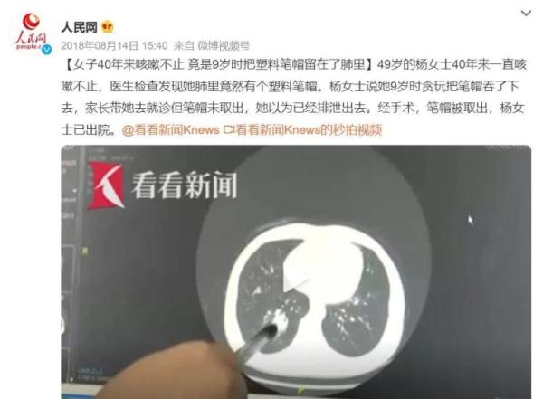 惊险！青岛一小学生咳嗽、发热8天，CT检查竟发现……