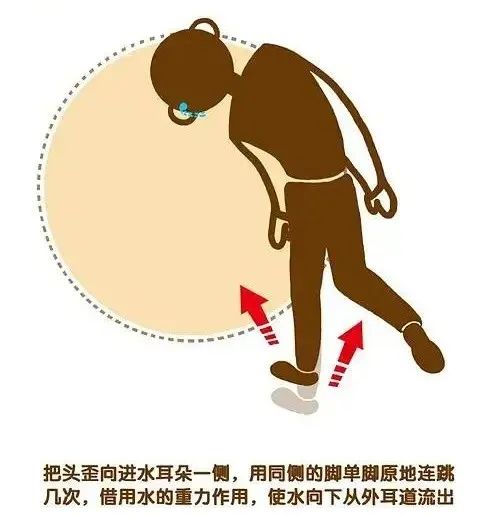 【健康科普】就去玩个水,没想到竟得了脚气!还能不能去泳池了? 【健康科普】就去玩个水,没想到竟得了脚气!还能不能去泳池了?