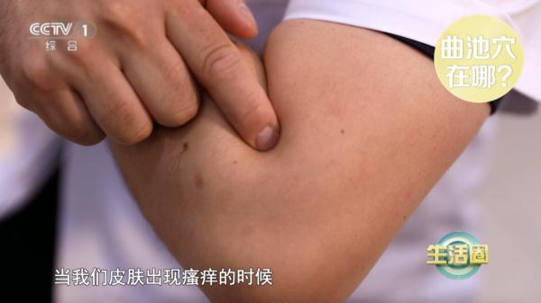 天热,如何对付痱子?看这一篇就够了! 天热,如何对付痱子?看这一篇就够了!